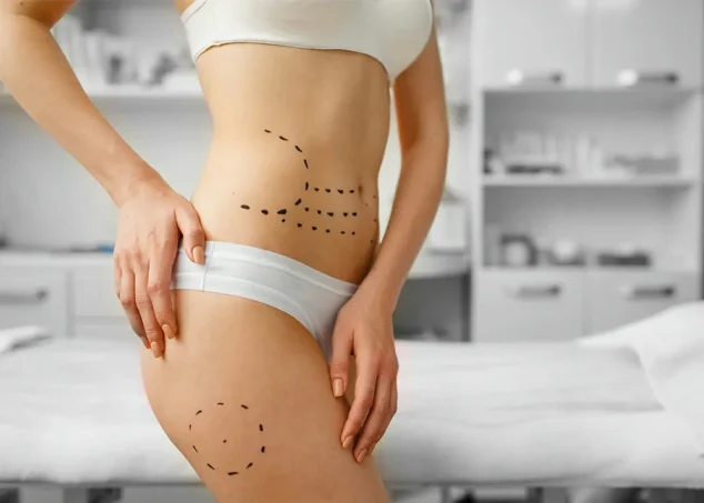 La Alquimia Moderna: Desvelando los Secretos de la Cirugía de Abdominoplastia en Málaga